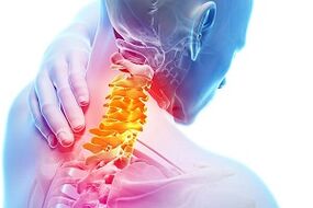 Symptoms of cervical osteochondrosis and nutritional rules for disease