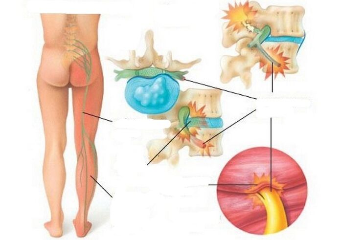 Type and cause of pain