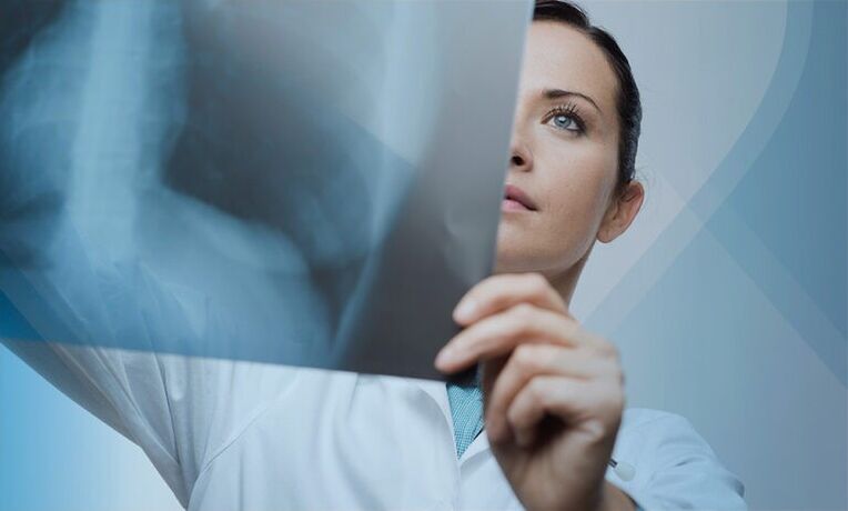 a doctor examines a picture of the cervical spine with osteochondrosis
