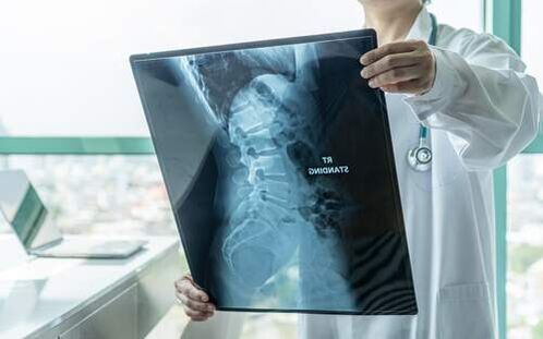 X-rays are a necessary diagnostic method if the back is sore